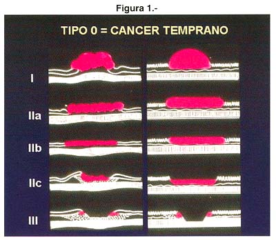 a06fig05g