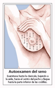 autoexamen