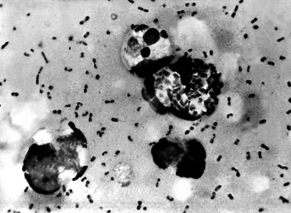 bacteria peste bubónica