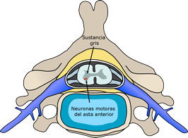 Polio_spinal_diagram_es