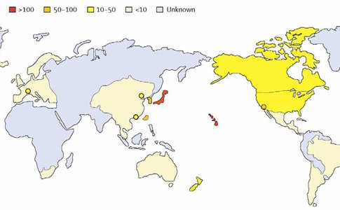 distribución