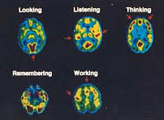 pet-scan