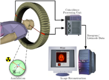 Pet Scan