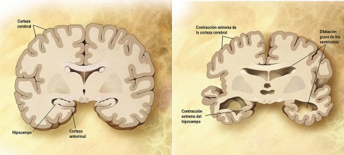 cerebro macro