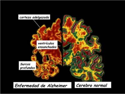 comparación