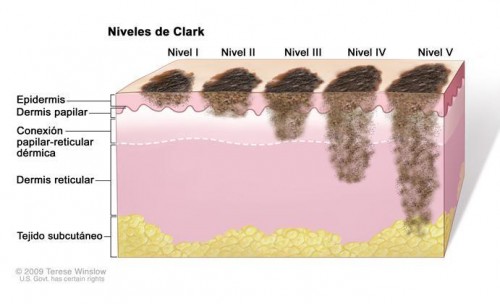 niveles mela